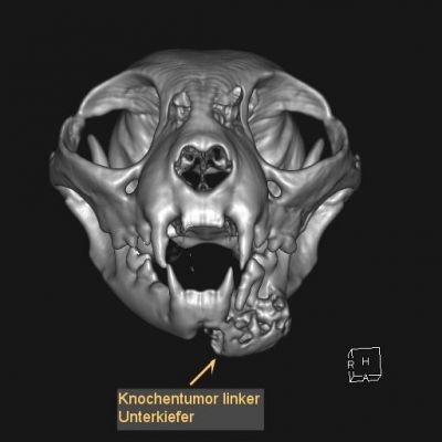 ct-knochentumor