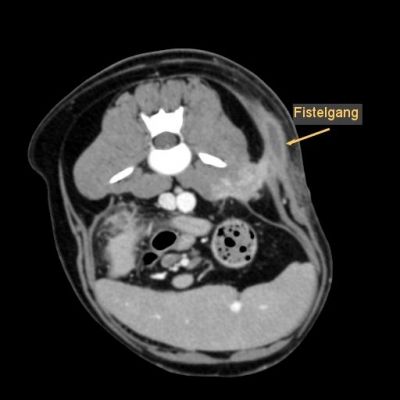 ct-ruecken-bauch