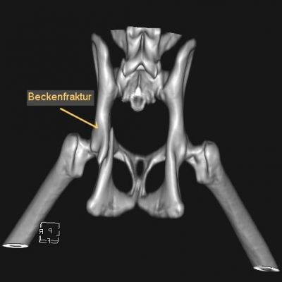 ct-beckenfraktur-3d