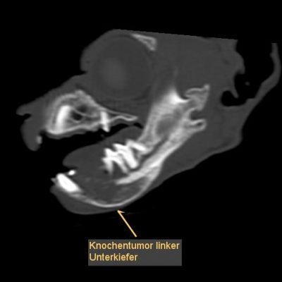 ct-knochentumor-unterkiefer