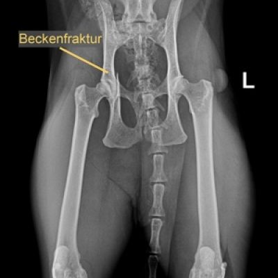 ct-beckenfraktur